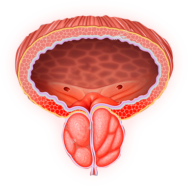 Просталис, Prostalis, при проблем с простата